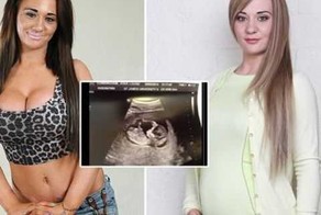 Модель сделает аборт ради участия в реалити-шоу