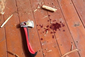 Воспоминания дровосека об отрубленном пальце