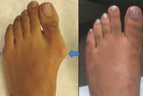 А вы бы стали резать себе ноги ради дизайнерской обуви?