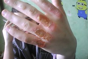 Не играйте с огнем