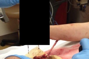 Почему вам стоит опасаться газонокосилок