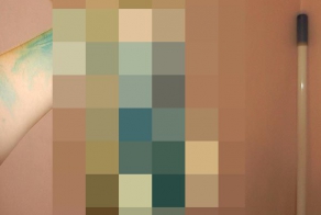 Последствия обработки царапин