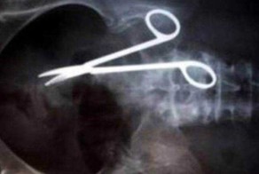 Мужчина 9 лет страдал из-за зажима, забытого в нем хирургами