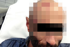 Женщина разбила парню голову своей туфлей