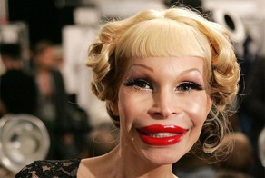 Жертвы пластической хирургии