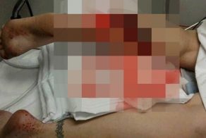 Неудачная попытка повесить занавески