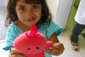 Хирургическое исправления волчьей пасти