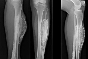 Укус гадюки 50-летней давности разорвал ногу женщины изнутри