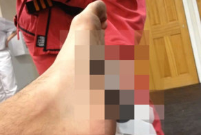 Ключ зажигания воткнулся в ногу