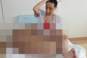 Врачи избавили жителя Китая от 110-килограммовой опухоли