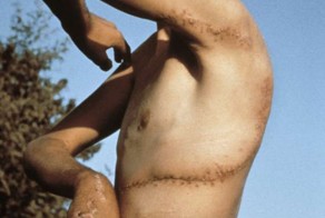 7 самых жутких нападений акул в истории