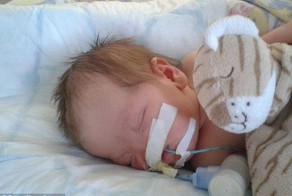 Девочка, родившаяся без носа