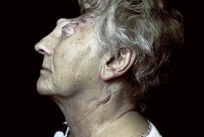 Искажённые лица пациентов