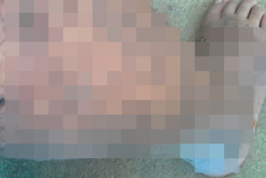 Врачи не могут поставить диагноз парню