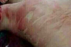 Не кормите диких зверей с руки