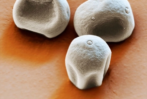 Частицы пыльцы и пыли под электронным микроскопом