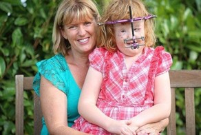 Врачи вынуджены заново строить тело девочки