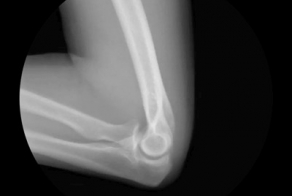 Суставы человеческого тела 