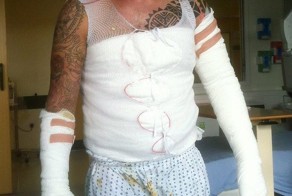 Парень пытался сделать ракетное топливо на кухне