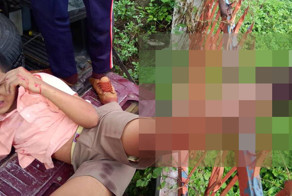 Больно наверное