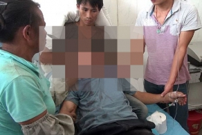 Металлический лом пробил голову китайца