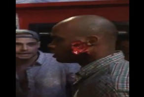 Темнокожий парень получает удар ножом в лицо