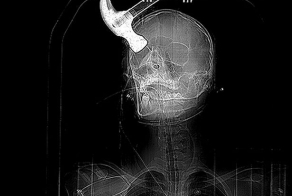 Британец разбил череп молотком  своему соседу-гею