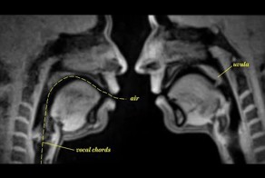 Повседневная жизнь снятая при помощи МРТ