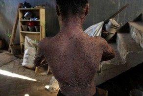 Мальчик-змея