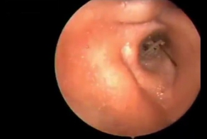 Ушной сюрприз