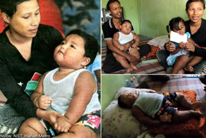 Родители пересадили свои глаза больному сыну