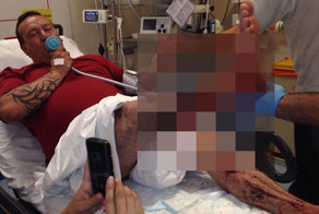 Последствия взрыва электронной сигареты