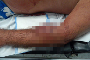 Британского туриста покусала обезьяна