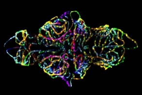 Мир под микроскопом: лучшие фото за 40 лет