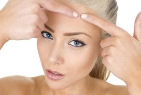 Как правильно удалять прыщи