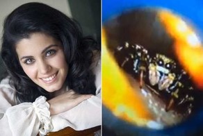 Паук жил неделю в голове у певицы