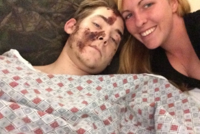 Восстановление руки после аварии