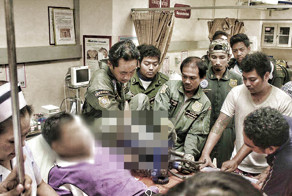 Травма на ферме по переработке кокосов