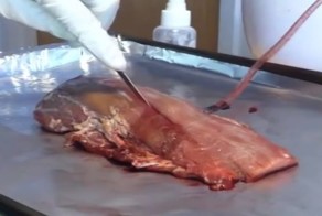 Изобретен гель останавливающий кровотечение мгновенно