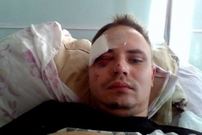 Борцов против Киевской хунты уже избивают в России!