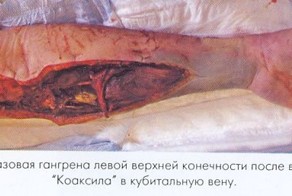 Ода коаксилу (особо впечатлительным смотреть запрещено!!!)