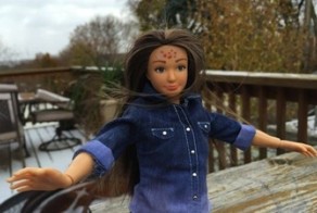 Реалистичную Барби наградили прыщами