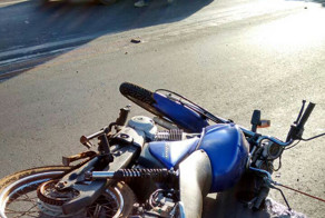 Бразильская мотожесть