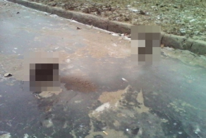 Заниженный таз...