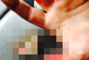 Случайно отсек себе кусочек пальца