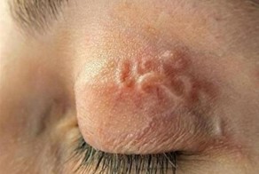 10 Самых "интересных болезней"