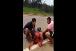 Мотоциклист в результате аварии лишился носа