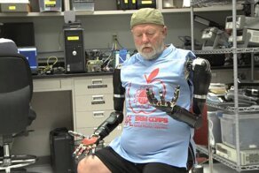 Лес Боу стал первым пациентом, научившимся управлять силой мысли