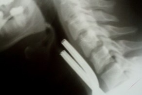 Кипятильник мнев рот!