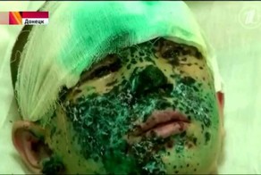 Мальчик Ваня: Страшное преступление украинских фашистов!